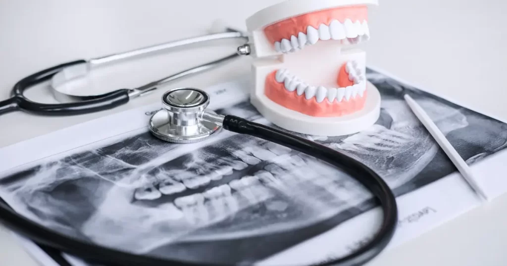 What is Oral and Maxillofacial Surgery?