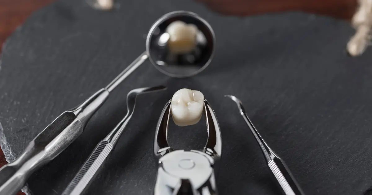 broken tooth