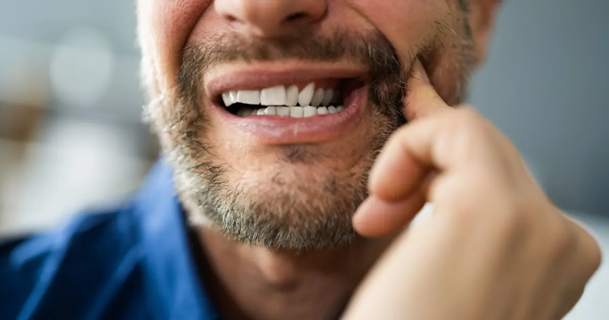 In Which Vitamin Deficiency Does Tooth Decay Occur?
