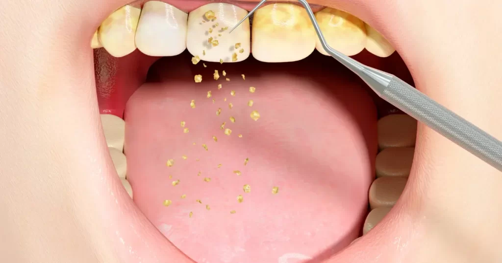 أمراض الأسنان