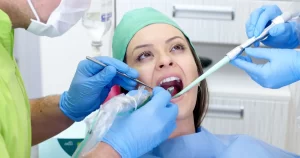 all-on-4- dental implants