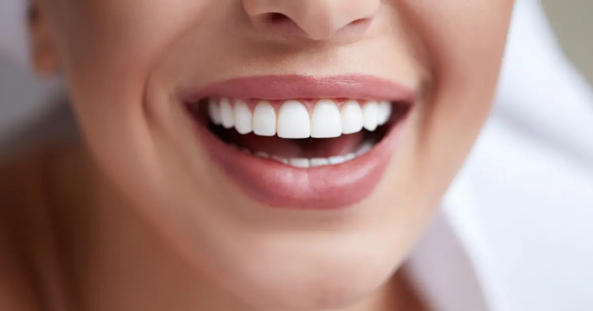 Who is Not Applied Teeth Whitening
