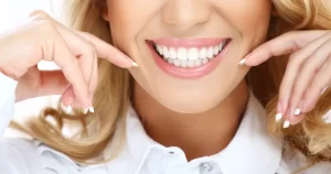 perfect smile