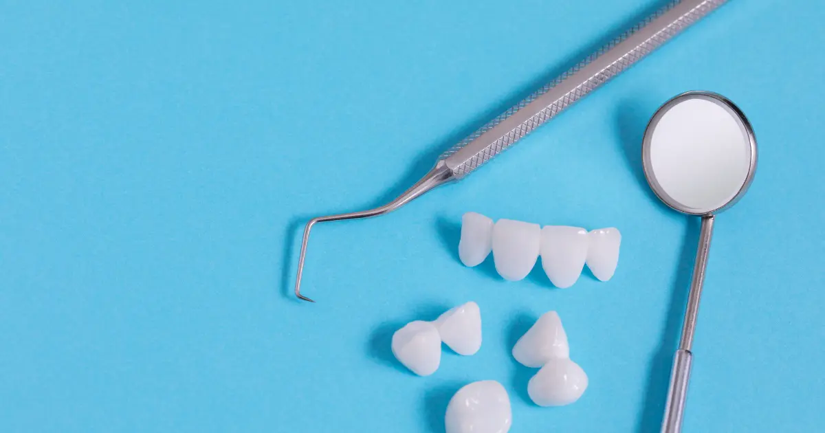 implants-vs-veneers