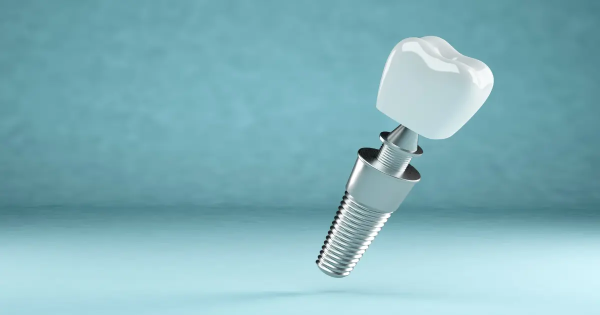 implant à une seule dent