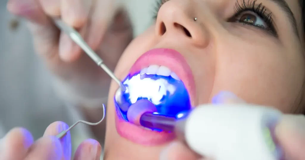 traitement dentaire au laser