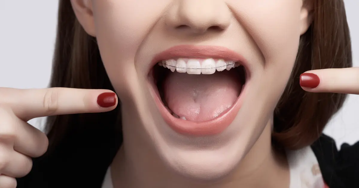 dentisterie esthetique