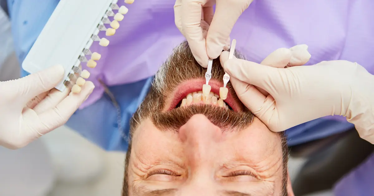 veneers implants
