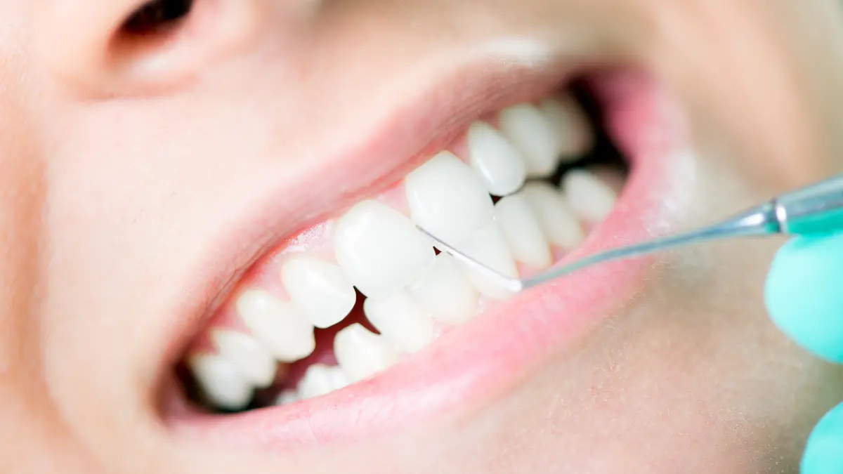 How A Dental Deep Cleaning Can Revitalize Your Dental Hygiene Routine?