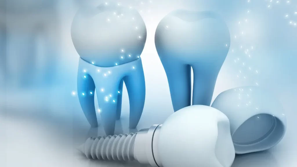 Is Same Day Dental Implants Possible?