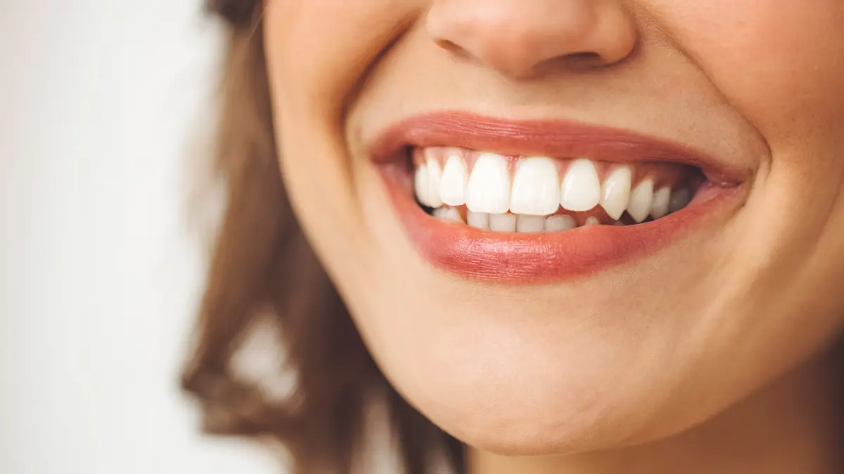 Gülüş tasarımı nedir?