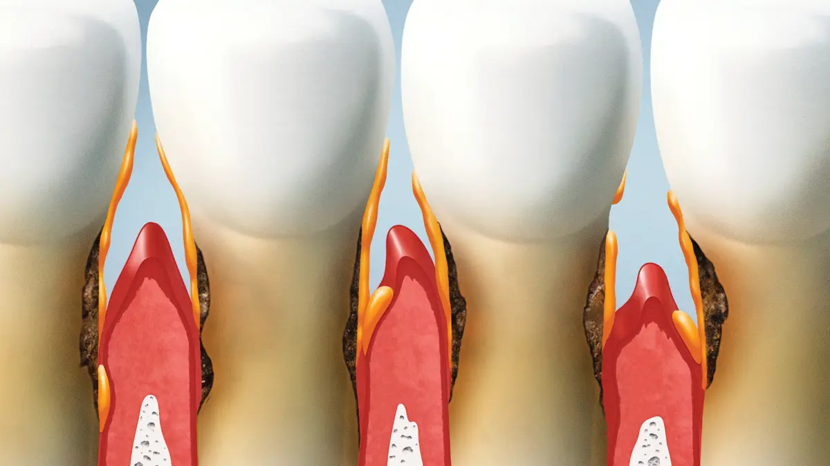 can dental aesthetics be corrected with gum shaping