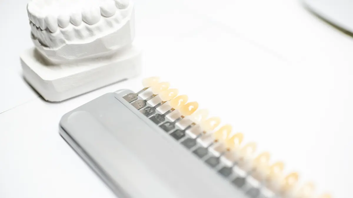 combien de temps fautil pour préparer les dents pour les facettes