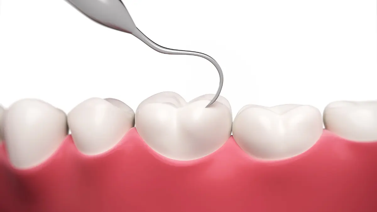 how is dental restoration done