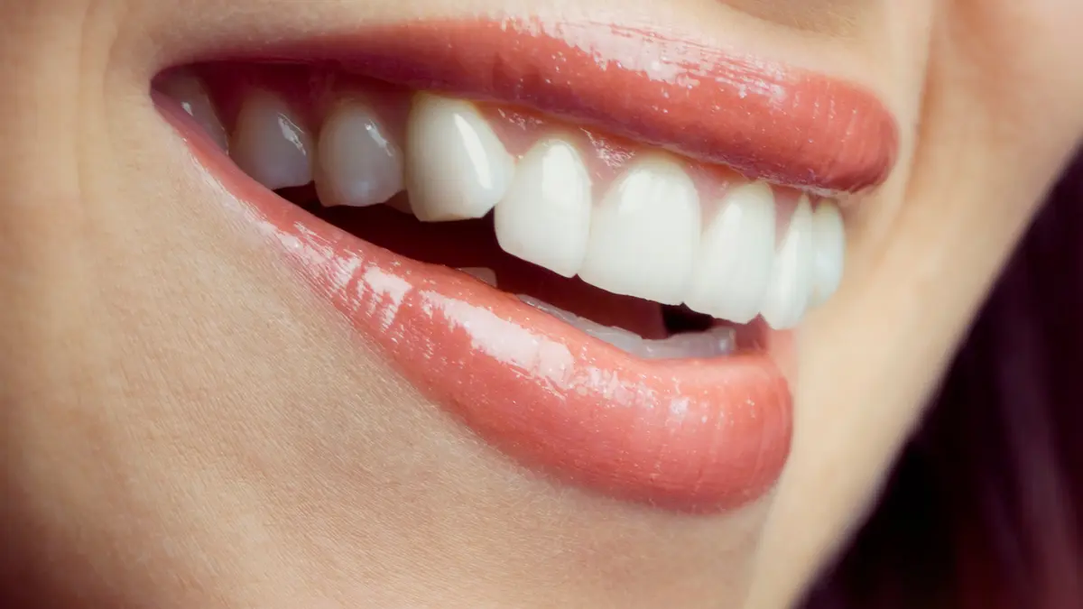 ideal smile design