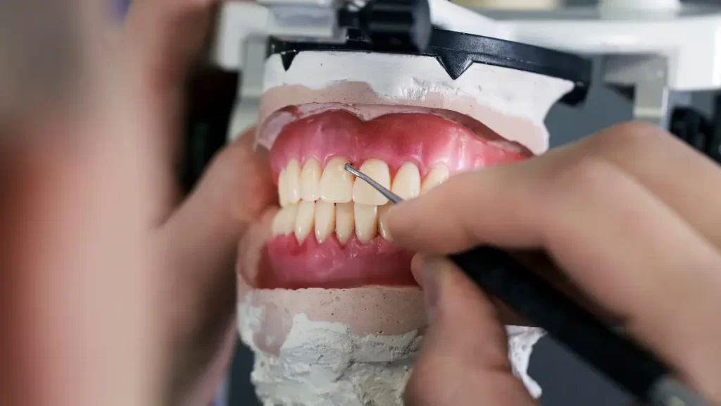 Qu’est-ce que l’esthétique dentaire? Comment faire?