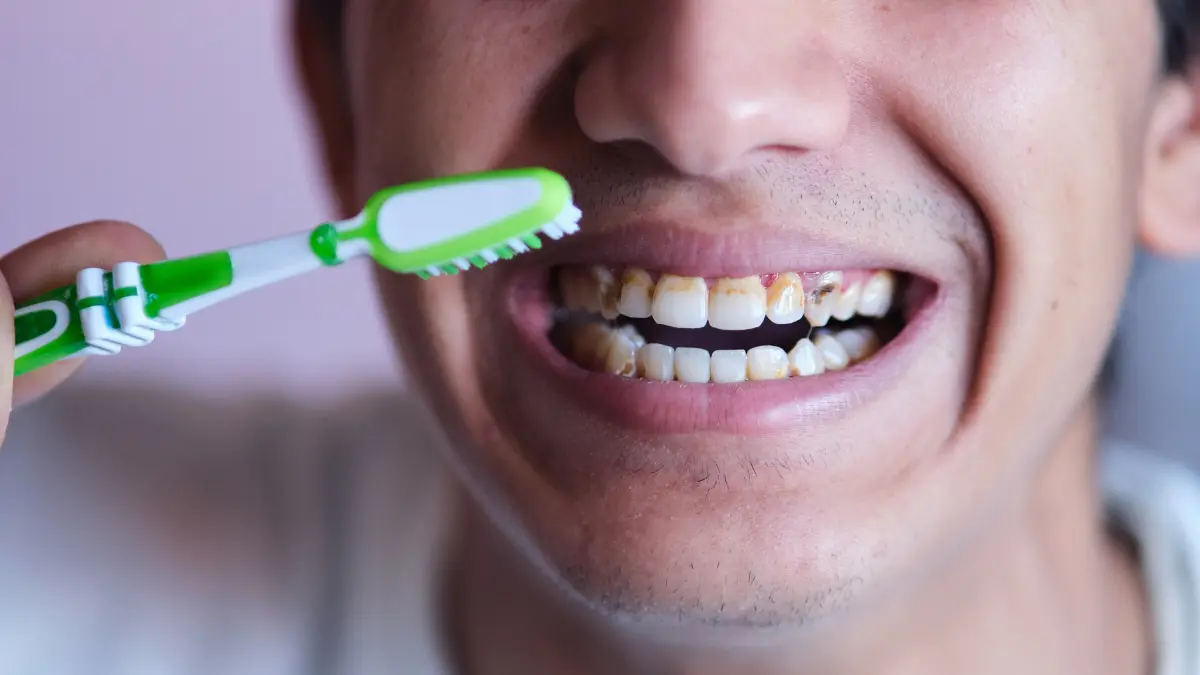 les taches noires sur les dents sont-elles permanentes