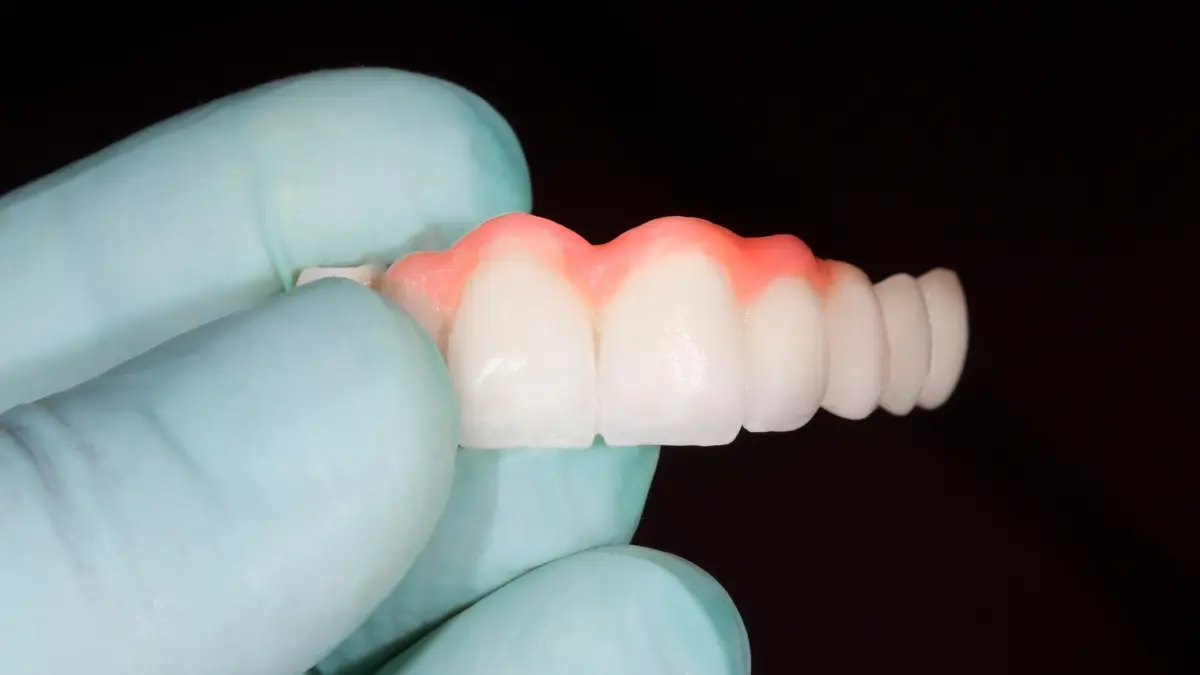 Symptoms of improrer dental bridge