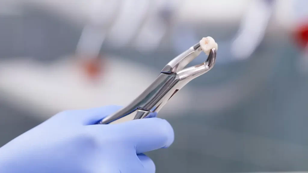 What Are Composite Bonding Teeth? How?
