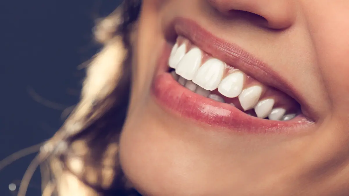 what are the components of the ideal smile