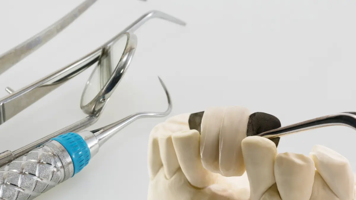 What is dental bridge?
