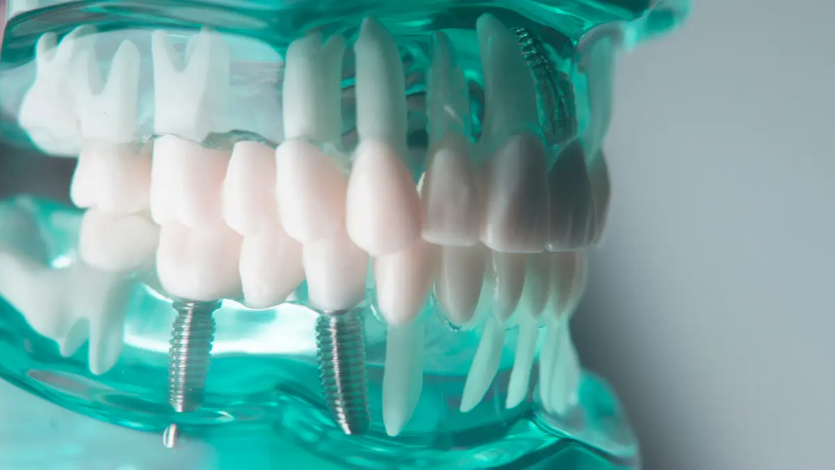 what is dental cbct