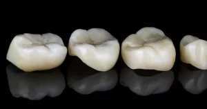 Diş İnley ve Onley Farkları