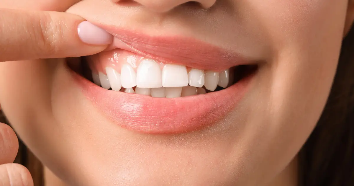 Why is Gingivectomy Performed