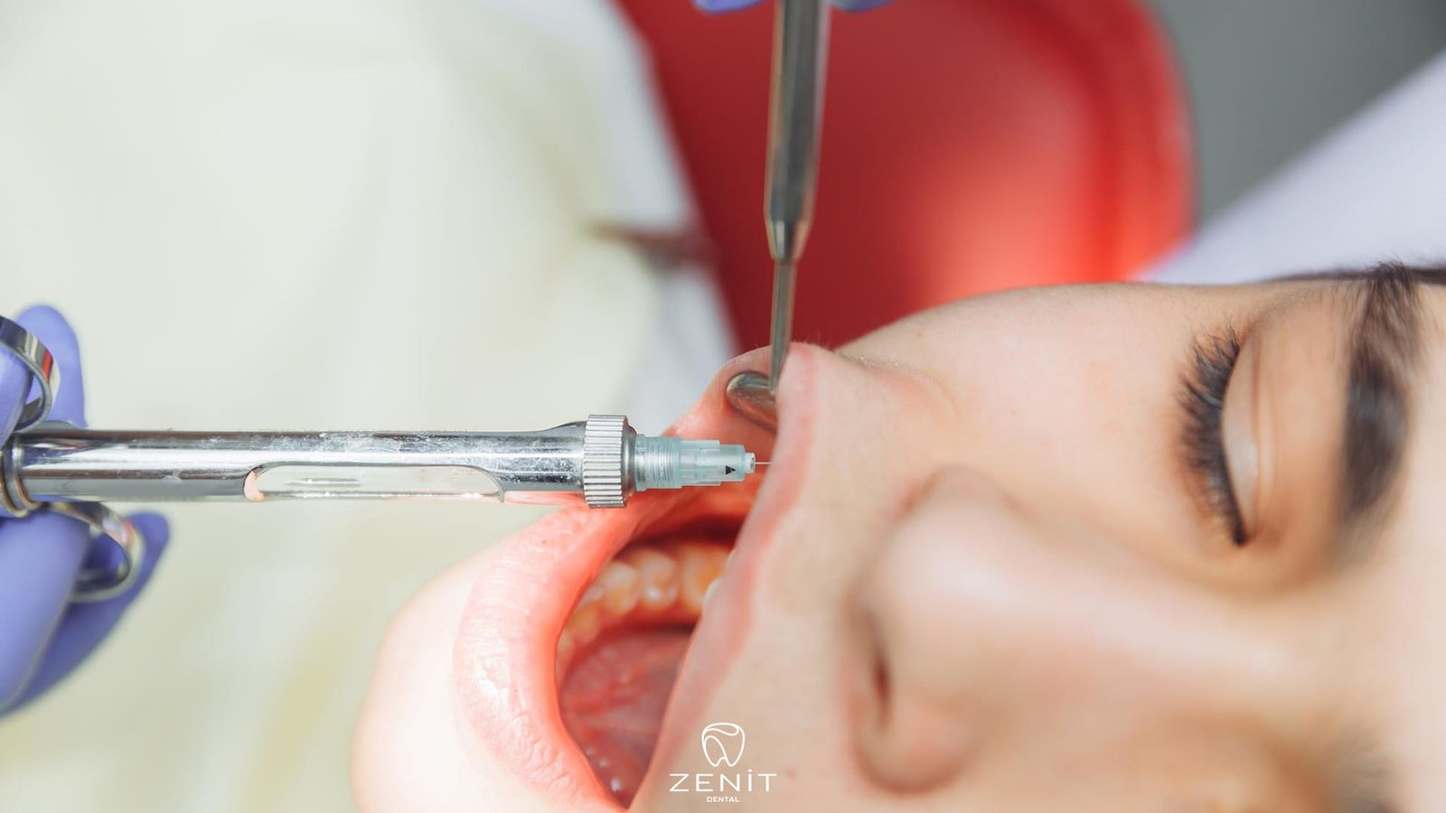 Tooth Extraction