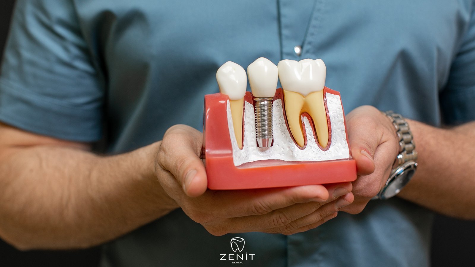 Why Should I Choose Implant Treatment in Turkey?
