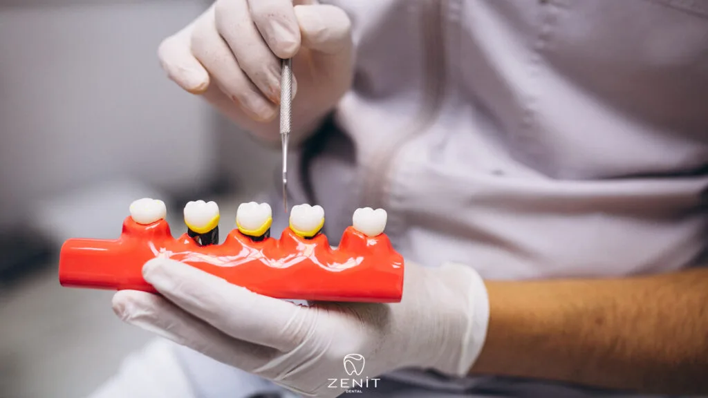 Restorative Dental Treatment