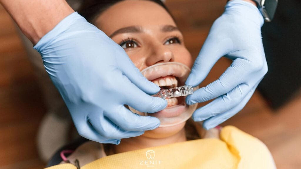 Orthodontic Treatment