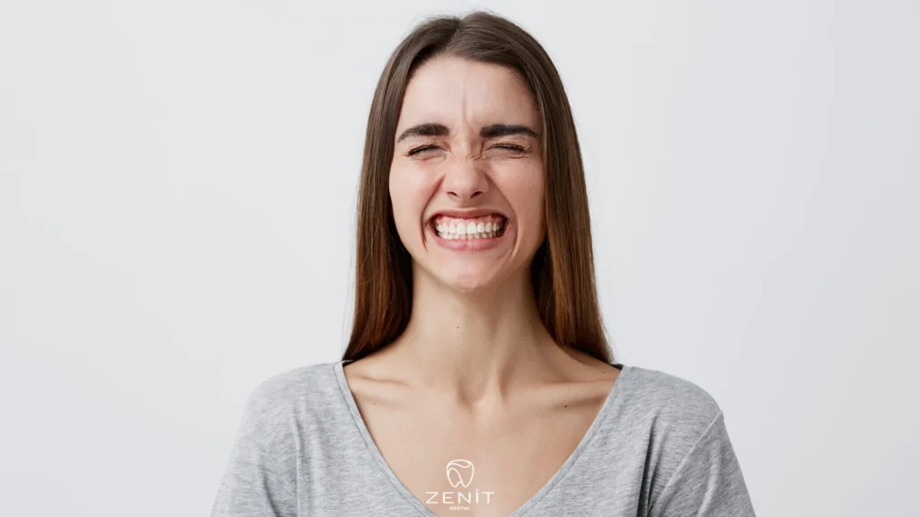 ما هي البروكسية ؟