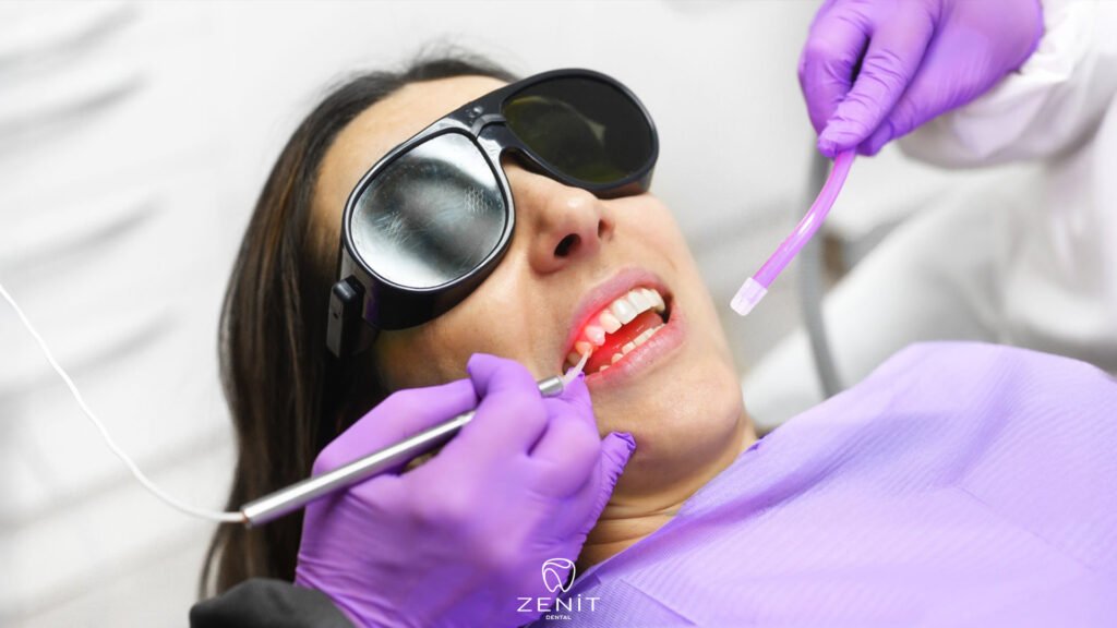 Laser Procedures 