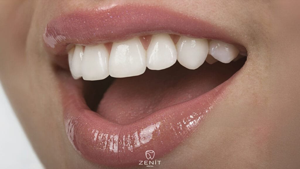 What Is Smile Design Dentistry?